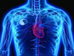 Взлом кардиостимуляторов может использоваться для шантажа